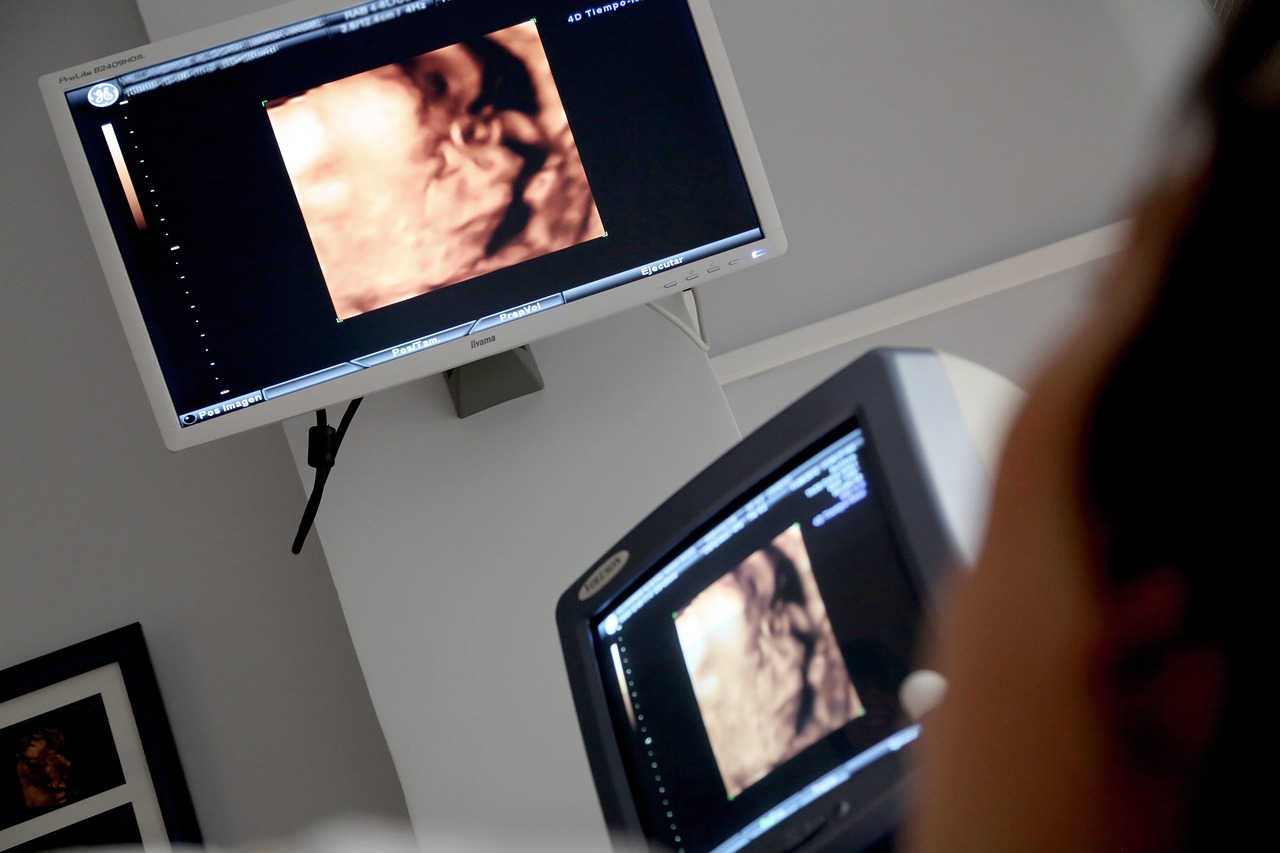 How Much Do Ultrasound Technicians Make?